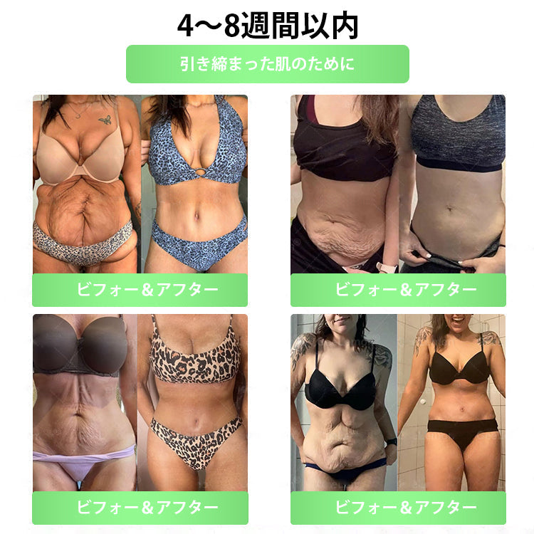 【完全新改良パッチ PLUS】 🌕🌕𝑳𝒖𝒙𝒂𝒓𝒊𝒔𝒆® モリンガ＆ベルベリン 10-IN-1 高機能ナノマイクロニードルパッチ（1日1回、7日で変化を実感）✅肥満・糖尿病・睡眠時無呼吸症候群・関節の悩み向け