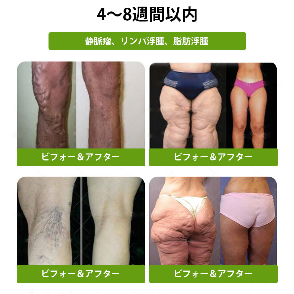【完全新改良パッチ PLUS】 🌕🌕𝑳𝒖𝒙𝒂𝒓𝒊𝒔𝒆® モリンガ＆ベルベリン 10-IN-1 高機能ナノマイクロニードルパッチ（1日1回、7日で変化を実感）✅肥満・糖尿病・睡眠時無呼吸症候群・関節の悩み向け